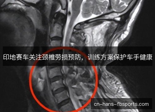 印地赛车关注颈椎劳损预防，训练方案保护车手健康